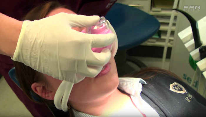 FAN-TV beim Zahnarzt Milan Michalides in Bremen Stuhr - Setzen eines Implantates unter Lachgas Sedierung